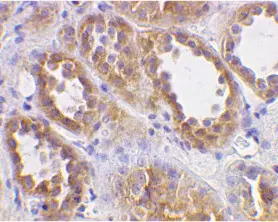 Anti Human ACE2 (N-Terminal) Antibody gallery image 2