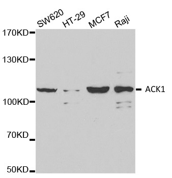 Anti ACK1 Antibody gallery image 1