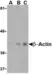 Anti Human Actin Beta (N-Terminal) Antibody thumbnail image 1