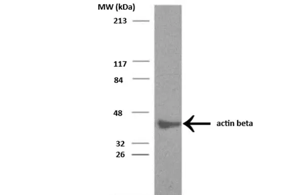 Anti Actin Beta Antibody gallery image 2