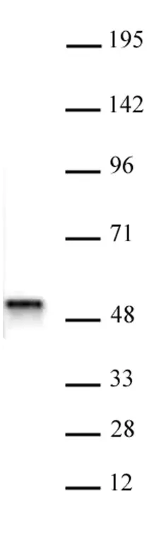 Anti Human ACTL6B Antibody gallery image 1