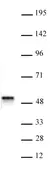 Anti Human ACTL6B Antibody thumbnail image 1