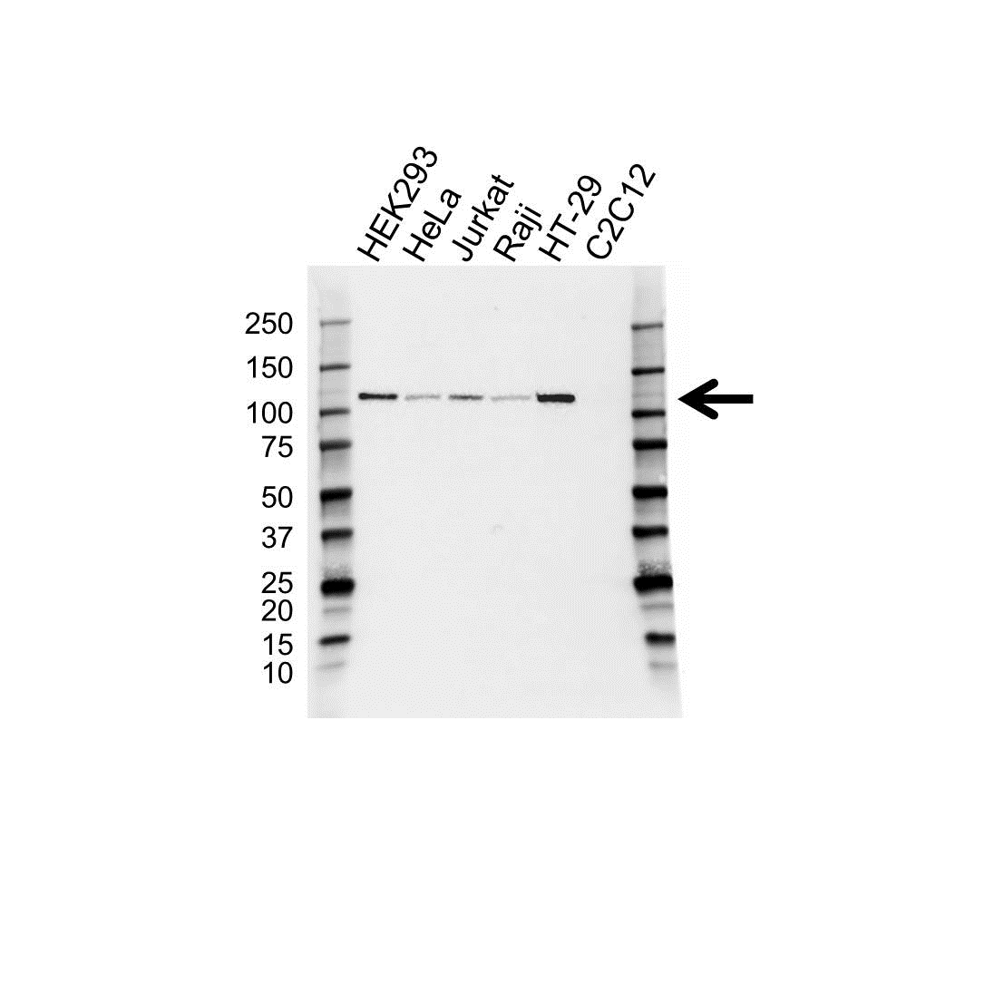 Anti ADD1 Antibody (PrecisionAb Polyclonal Antibody) gallery image 1