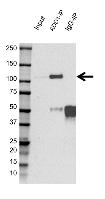Anti ADD1 Antibody (PrecisionAb Polyclonal Antibody) gallery image 2