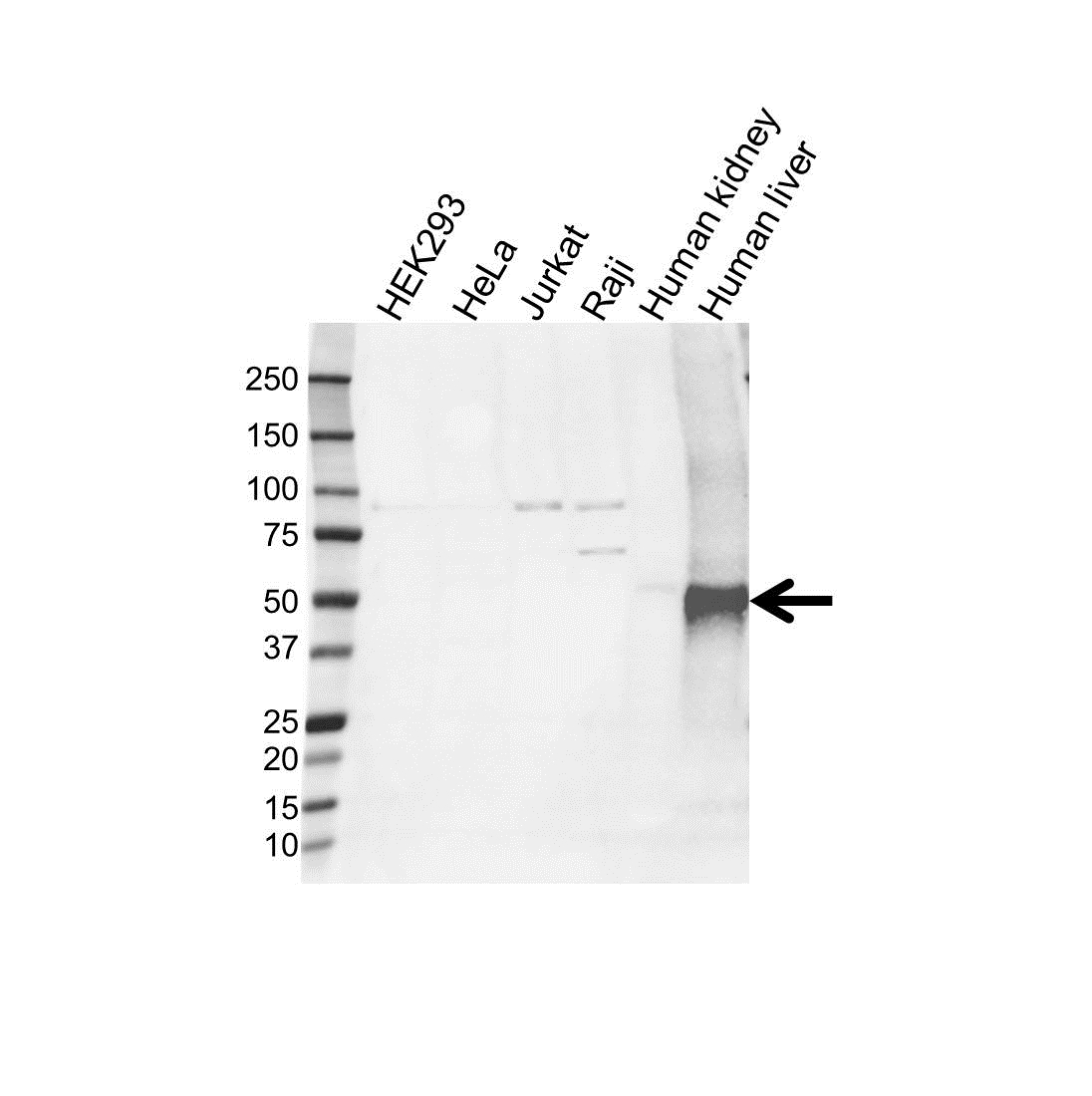 Anti ADHFE1 Antibody (PrecisionAb Polyclonal Antibody) gallery image 1
