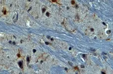 Anti AIF1 (C-Terminal) Antibody gallery image 1