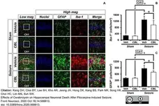 Anti AIF1 (C-Terminal) Antibody gallery image 4