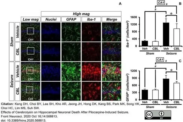 Anti AIF1 (C-Terminal) Antibody gallery image 4