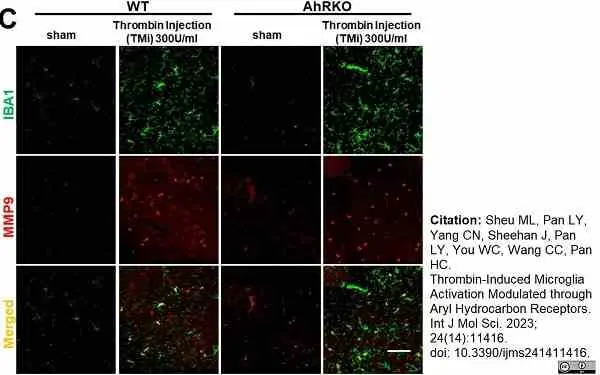 Anti AIF1 (C-Terminal) Antibody gallery image 6