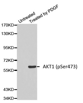Anti AKT1 (pSer473) Antibody gallery image 1