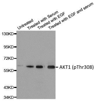 Anti AKT1 (pThr308) Antibody gallery image 1