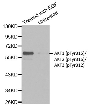 Anti AKT1 (pTyr315)/AKT2 (pTyr316)/AKT3 (pTyr312) Antibody gallery image 1