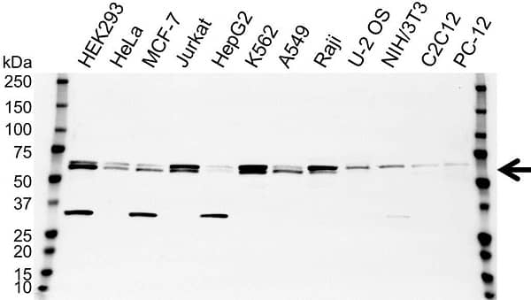 Anti AKT2 Antibody (PrecisionAb Polyclonal Antibody) gallery image 1
