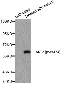 Anti AKT2 (pSer474) Antibody gallery image 1