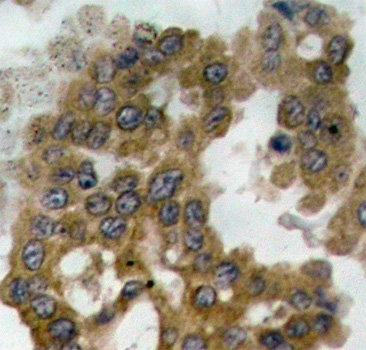 Anti AKT2 (pSer474) Antibody thumbnail image 2