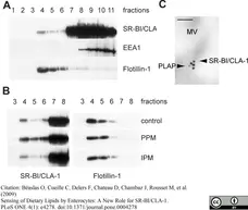 Anti Human Alkaline Phosphatase Antibody gallery image 1