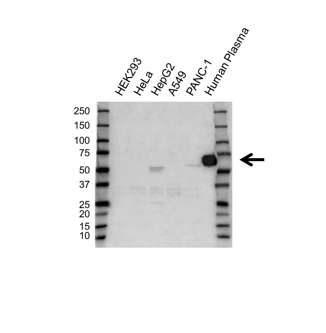 Anti ALPHA-1-ANTICHYMOTRYPSIN Antibody (PrecisionAb Polyclonal Antibody) gallery image 1