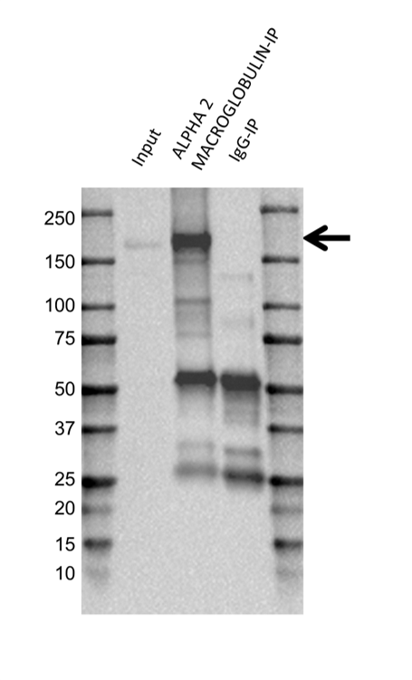 Anti Alpha 2 Macroglobulin Antibody (PrecisionAb Polyclonal Antibody) gallery image 2