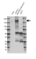 Anti Alpha 2 Macroglobulin Antibody (PrecisionAb Polyclonal Antibody) thumbnail image 2