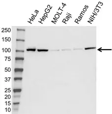 Anti Alpha ACTININ-1 Antibody (PrecisionAb Polyclonal Antibody) gallery image 1
