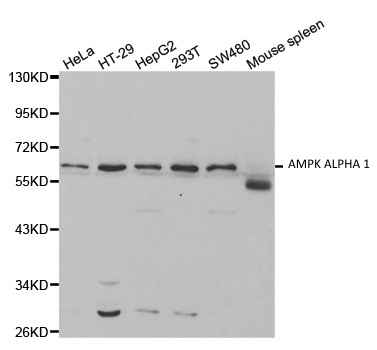 Anti AMPK Alpha 1 Antibody gallery image 1