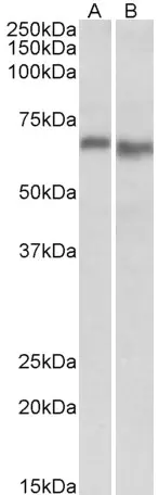 Anti Human AMPK Alpha 2 Antibody gallery image 2