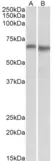Anti Human AMPK Alpha 2 Antibody thumbnail image 2