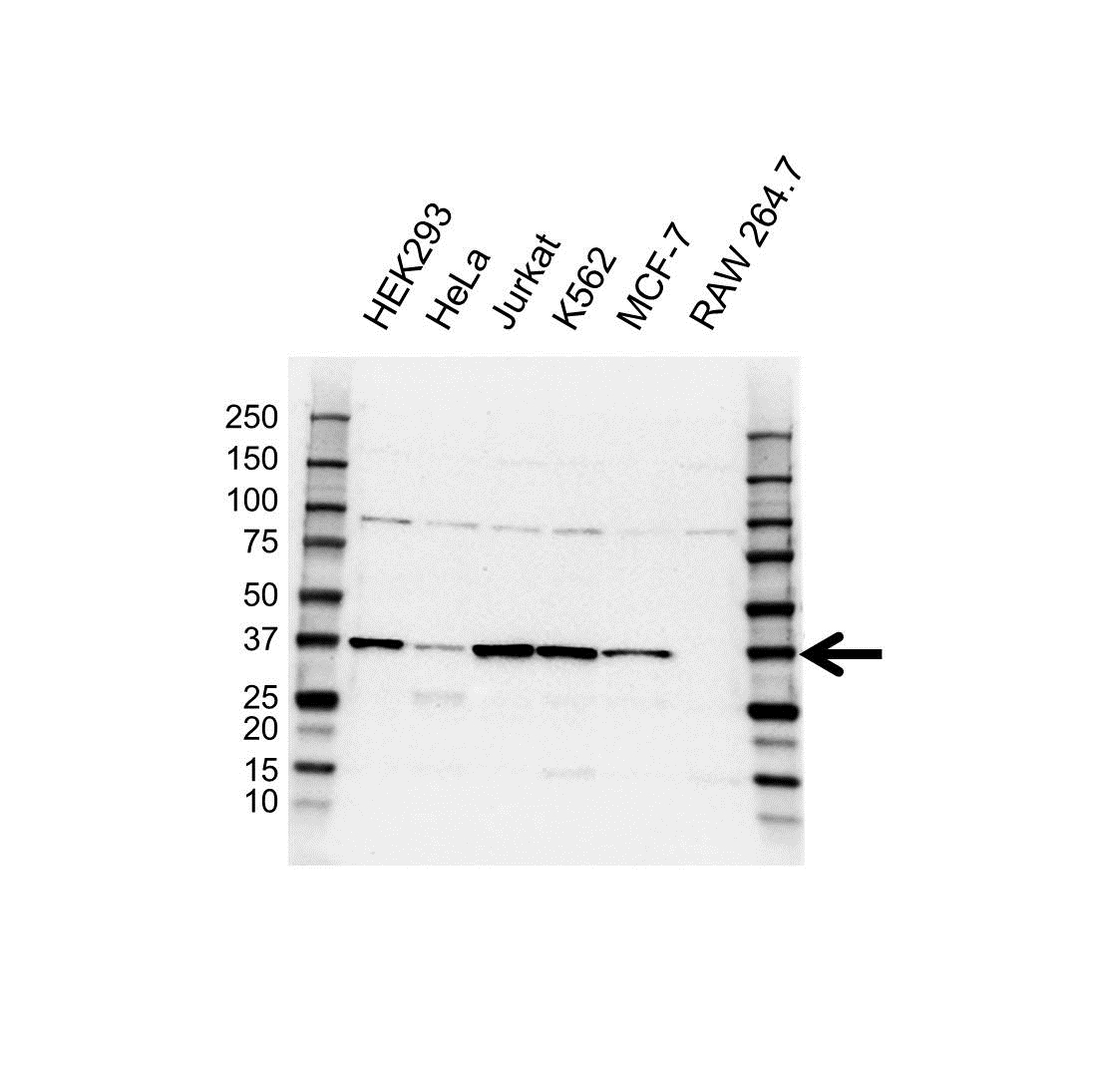 Anti AMPK Gamma 1 Antibody (PrecisionAb Polyclonal Antibody) gallery image 1