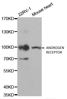 Anti Androgen Receptor Antibody gallery image 1
