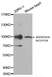 Anti Androgen Receptor Antibody thumbnail image 1