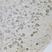 Anti Androgen Receptor Antibody thumbnail image 2