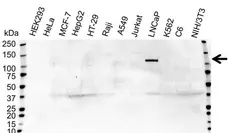 Anti Androgen Receptor Antibody (PrecisionAb Polyclonal Antibody) gallery image 1