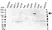 Anti Androgen Receptor Antibody (PrecisionAb Polyclonal Antibody) thumbnail image 1