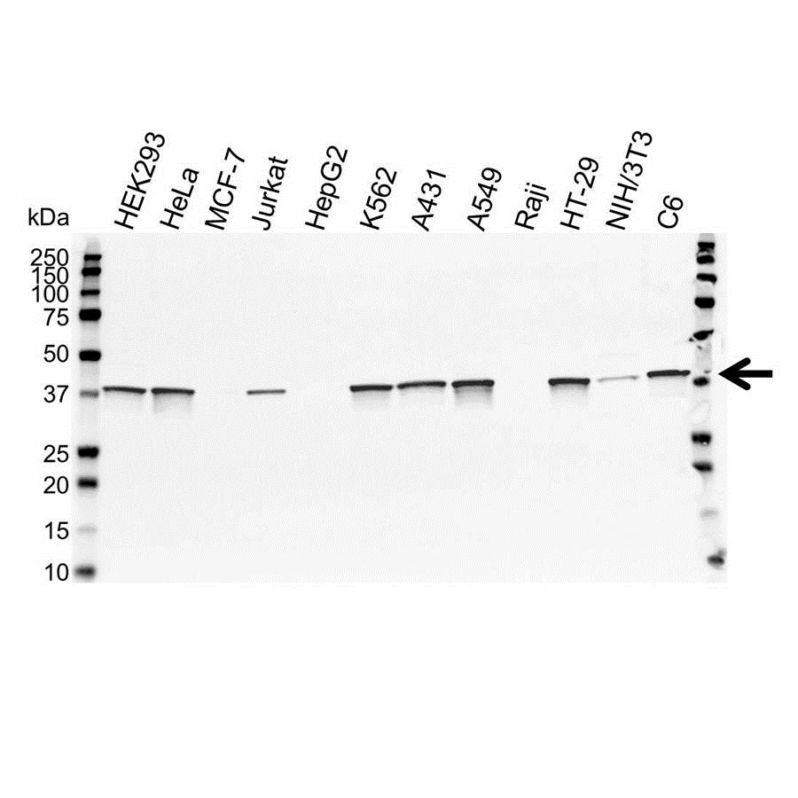 Anti Annexin I Antibody (PrecisionAb Polyclonal Antibody) gallery image 1