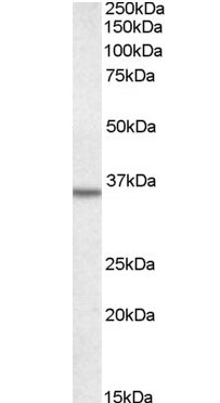 Anti Human Annexin II (N-Terminal) Antibody gallery image 1