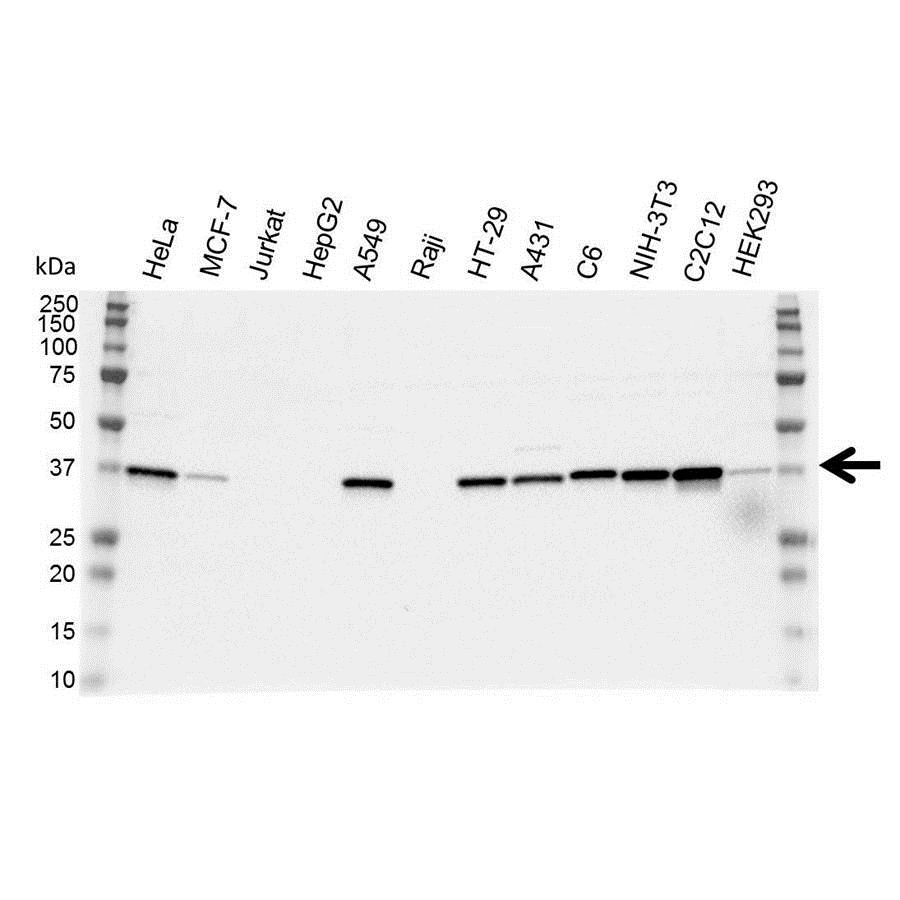 Anti Annexin II Antibody (PrecisionAb Polyclonal Antibody) gallery image 1