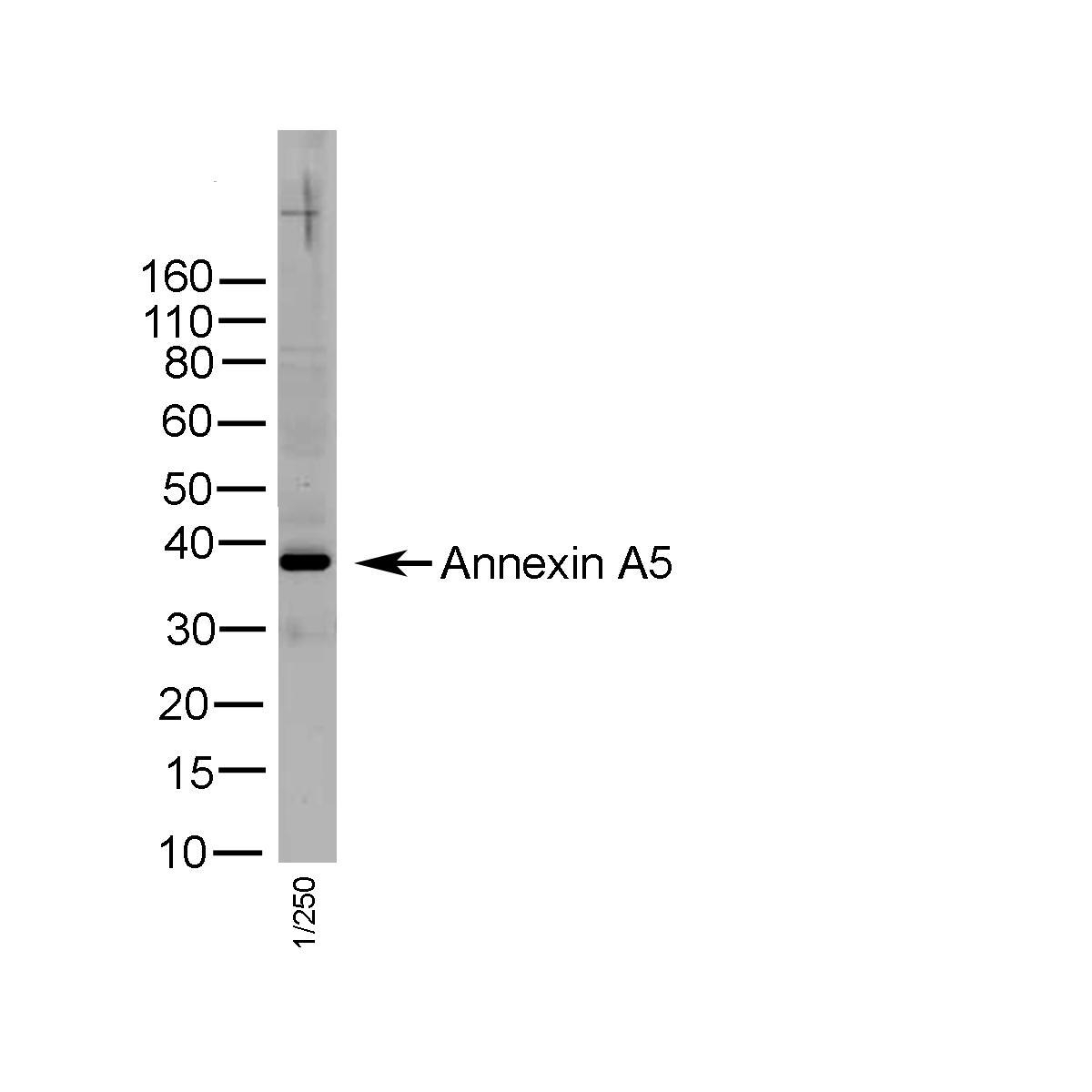 Anti Human Annexin V Antibody gallery image 1