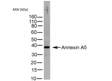 Anti Human Annexin V Antibody gallery image 1