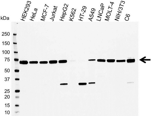 Anti Annexin VI Antibody (PrecisionAb Polyclonal Antibody) gallery image 1