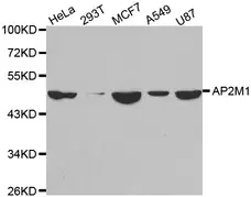 Anti AP2M1 Antibody gallery image 1