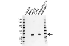 Anti Apolipoprotein E Antibody (PrecisionAb Polyclonal Antibody) gallery image 1