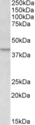 Anti Human Apolipoprotein L1 (C-Terminal) Antibody thumbnail image 1