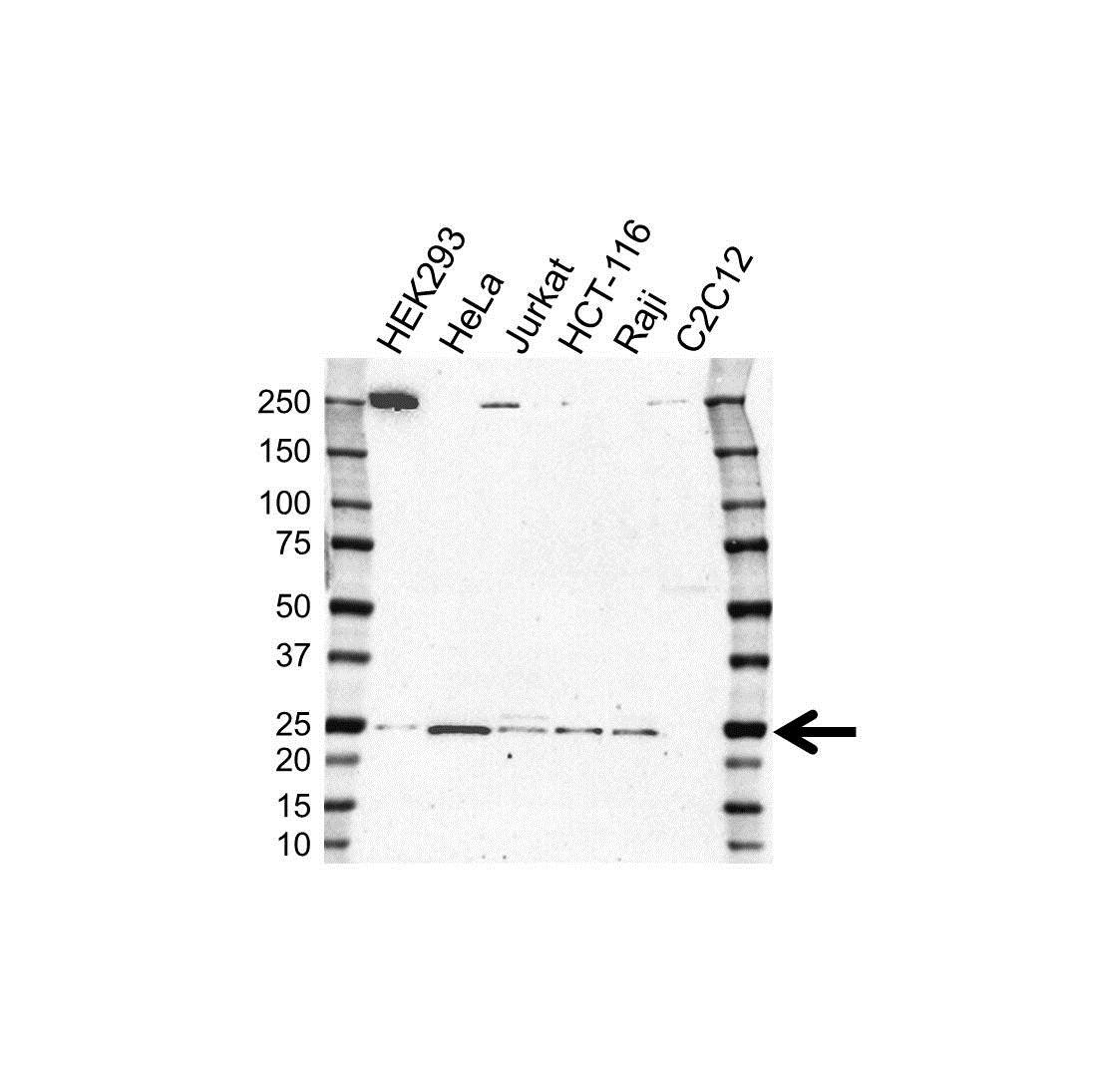 Anti ARD1A Antibody (PrecisionAb Polyclonal Antibody) gallery image 1