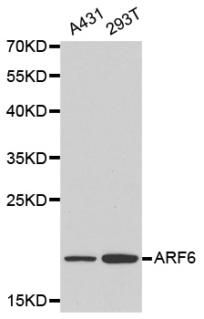 Anti ARF6 Antibody gallery image 1