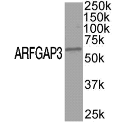 Anti Human ARFGAP3 Antibody gallery image 1