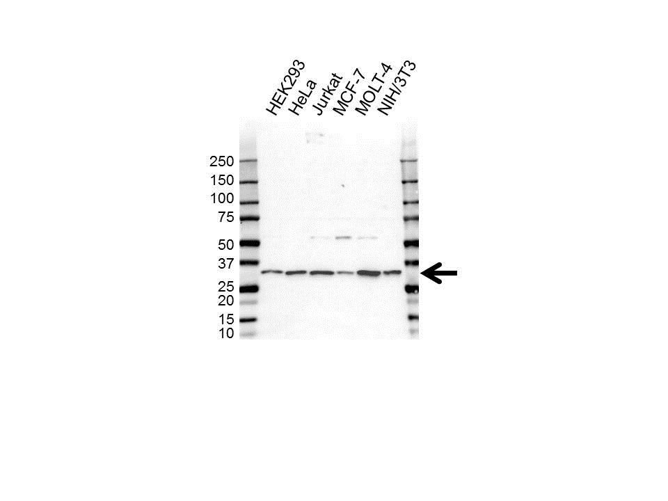 Anti ARPC2 Antibody (PrecisionAb Polyclonal Antibody) gallery image 1