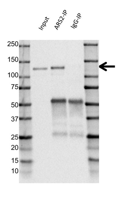 Anti ARS2 Antibody (PrecisionAb Polyclonal Antibody) gallery image 2