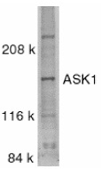 Anti Human ASK1 (C-Terminal) Antibody gallery image 1