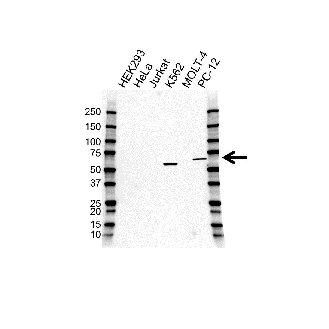 Anti Asns Antibody (PrecisionAb Polyclonal Antibody) gallery image 1