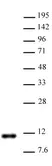 Anti Asymmetric-Di-Methyl-Histone H4 (Arg3) Antibody thumbnail image 1